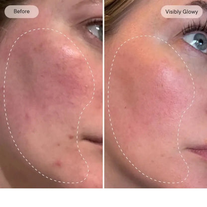 Rejuvenate the look of dull skin with the Micro-Infusion Facial System